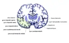 Frontalschnitt