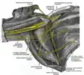 Der rechte Plexus brachialis (der infraclaviculäre Anteil), Sicht von vorn unten