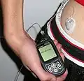 Insulinpumpe