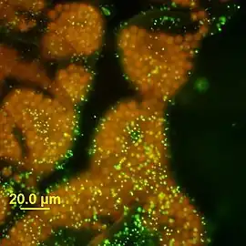 Kolonie von Microcystis wesenbergii unter dem Epifluoreszenzmikroskop, DNA mit SYTOX grün gefärbt