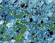 Kolorierte TEM-Aufnahme von Mpox-Viruspartikeln (grün), die in infizierten VERO E6-Zellen (blau) gefunden wurden. Die Viruspartikel befinden sich in unterschiedlichen Reifestadien, was zu unterschiedlichen Formen führt