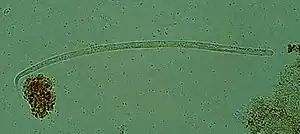 Onchocerca volvulus