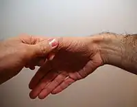 Finkelstein-Test gemäß Originalbeschreibung