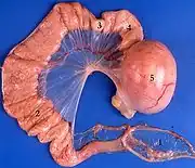 Legedarm eines Haushuhns: 1 Infundibulum, 2 Magnum, 3 Isthmus, 4 Uterus, 5 Vagina mit Ei