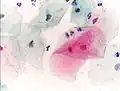Normale Plattenepithelzellen im Abstrich