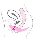 Platzierung der Kugeln in der Vagina