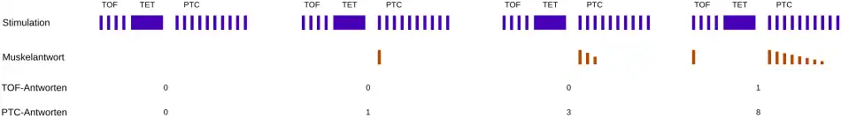 Post tetanic count