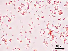 Salmonella typhimurium in der Gramfärbung