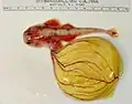 Embryo des ovoviviparen Engelhais mit Dottersack