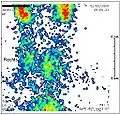Schilddrüsenszintigrafie bei Subakuter Thyreoiditis: verminderter Uptake.