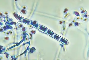 Trichophyton rubrum